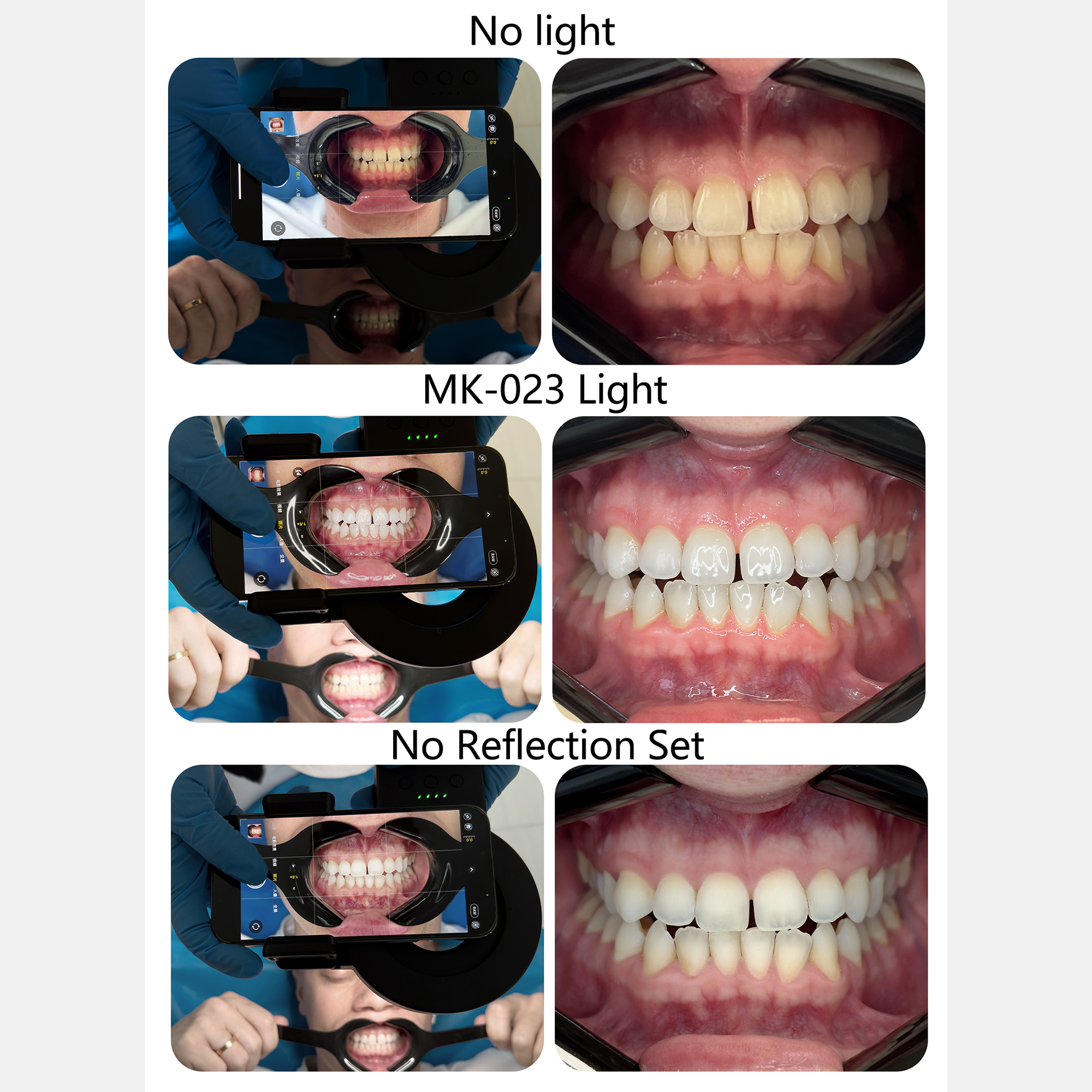 HERA MK-23 Intraoral Dental Ph - Photography Lighting Ring recension och pris